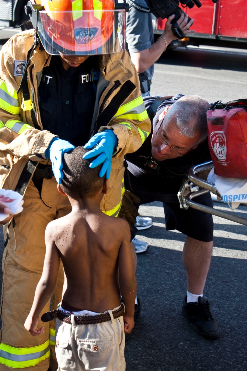 Little kid bleeding head